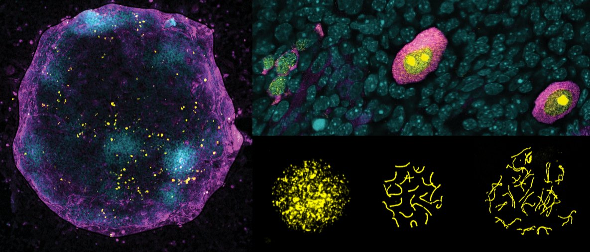 Jacqueline Severino (@jacquelineseve7) on Twitter photo The #Xchromosome matters. Check out our latest study in <a href="/embojournal/">The EMBO Journal</a> where we show the implications of X-chromosome activity on meiotic entry in mouse primordial germ cells in vitro embopress.org/doi/full/10.15… . (1/12) The #Xchromosome matters. Check out our latest study in <a href="/embojournal/">The EMBO Journal</a> where we show the implications of X-chromosome activity on meiotic entry in mouse primordial germ cells in vitro embopress.org/doi/full/10.15… . (1/12)