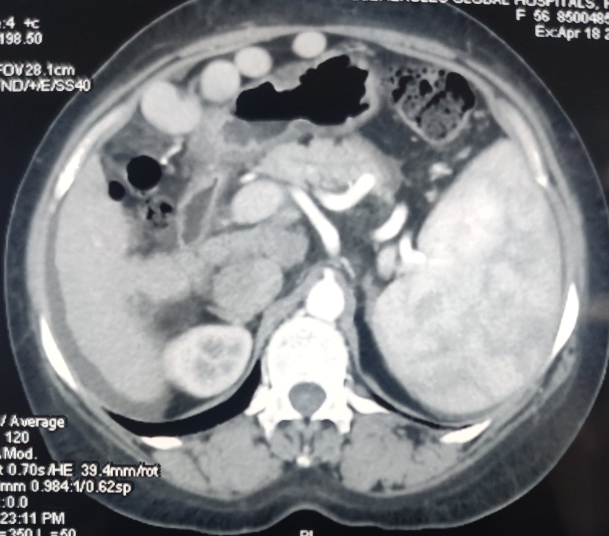 Faisal Masoodi tweet media