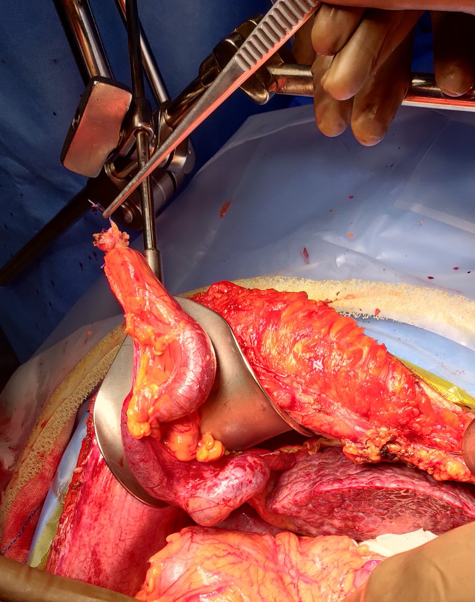 Faisal Masoodi tweet media