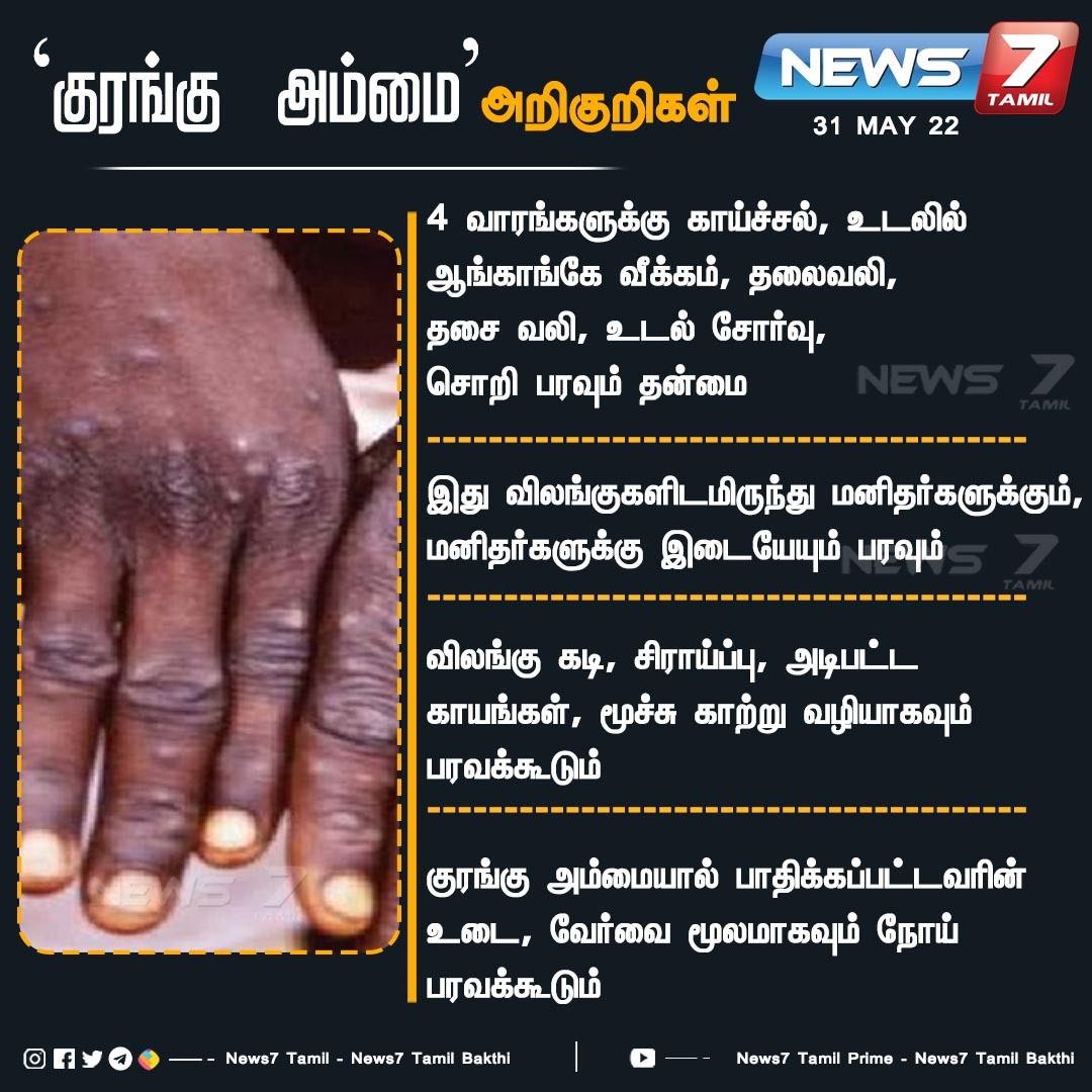 news7tamil's tweet image. குரங்கு அம்மை - அறிகுறிகள்

news7tamil.live | #monkeypox | #monkey | #monkeyfever | #News7TamilUpdates | #News7Tamil