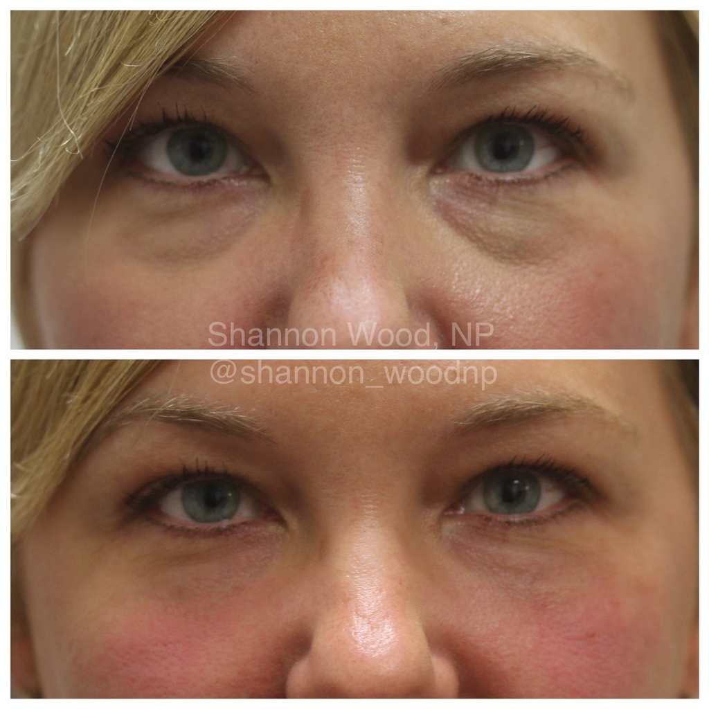 Nayak Plastic Surgery & Avani Derm Spa tweet media