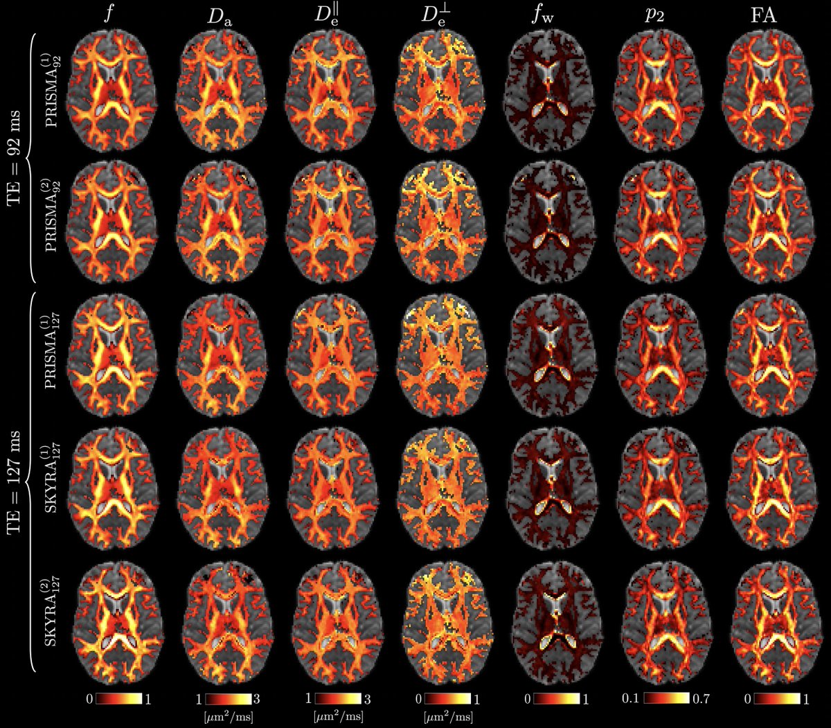 santicoelho's tweet photo. Check out our latest paper on the reproducibility of white matter modeling with diffusion MRI! 👇

https://t.co/FlacOuvdC7

@stbaete @GregLemberskiy @badesaron @jelle_veraart @dimanovikov @elsfi 

1/5 https://t.co/Gw1QOcVIjv