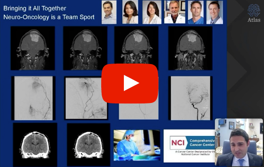 As we close out #BrainTumorAwarenessMonth, learn how new innovations have improved the treatment of #BrainMetastases and other neurological conditions by watching this Neurosurgical Atlas (<a href="/AaronCohenGadol/">Aaron Cohen-Gadol, MD</a>) presentation by our chair, <a href="/DrAlexKhalessi/">Alexander Khalessi, MD, MBA</a>:
bit.ly/3fZkHJB