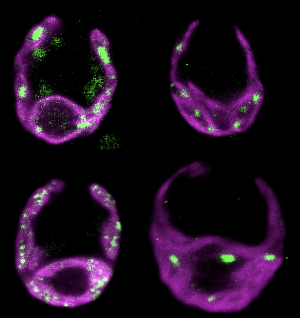 Preprint! A Chloroplast Protein Atlas Reveals Novel Structures and Spatial Organization of Biosynthetic Pathways!
biorxiv.org/content/10.110…
Localizations searchable on chlamylibrary.org
Below are four chloroplasts (magenta), each with a different tagged protein (green).