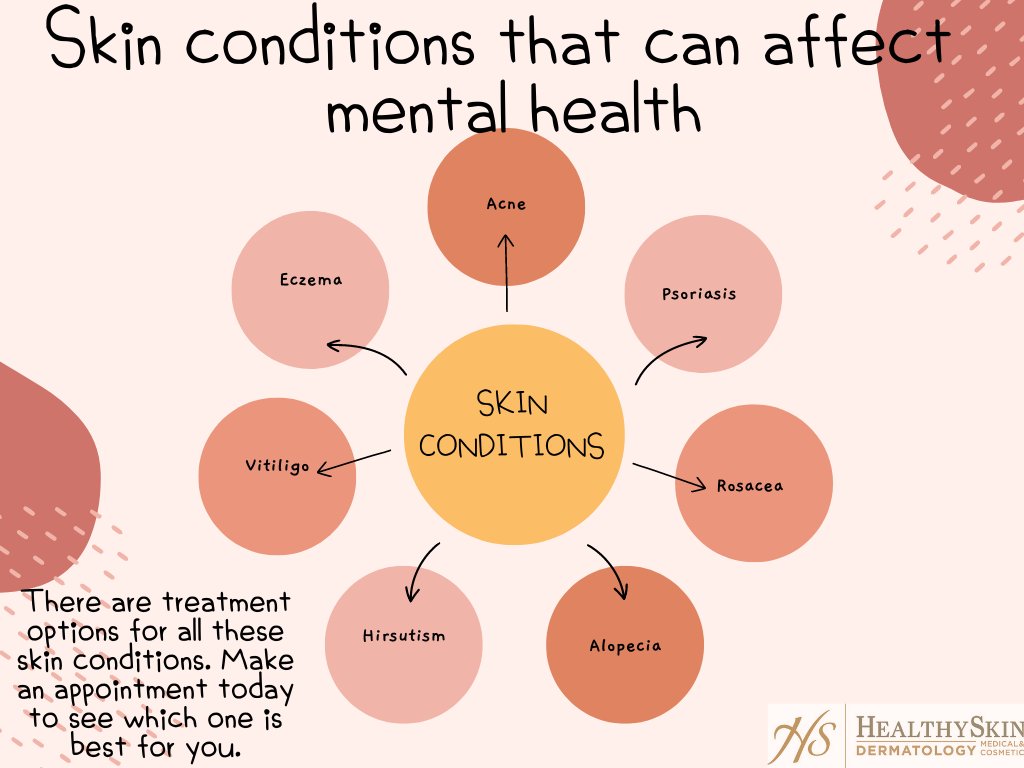 HSDermatology's tweet photo. For more information and to make an appointment online visit our website: https://t.co/qtHm1PN3oF

#healthyskindermatology #healthyskin #dermatology #mentalhealth https://t.co/0eIrQOTuVo