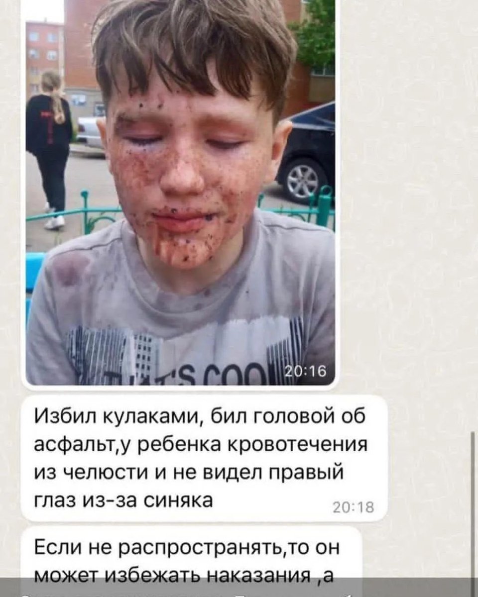 iamYerlan's tweet photo. В Косшы взрослый жесткого избил 9 летнего ребёнка из за ссоры с его 9 сыном

Написано заявление, но его так и не арестовали. https://t.co/ug6y2jldHE
