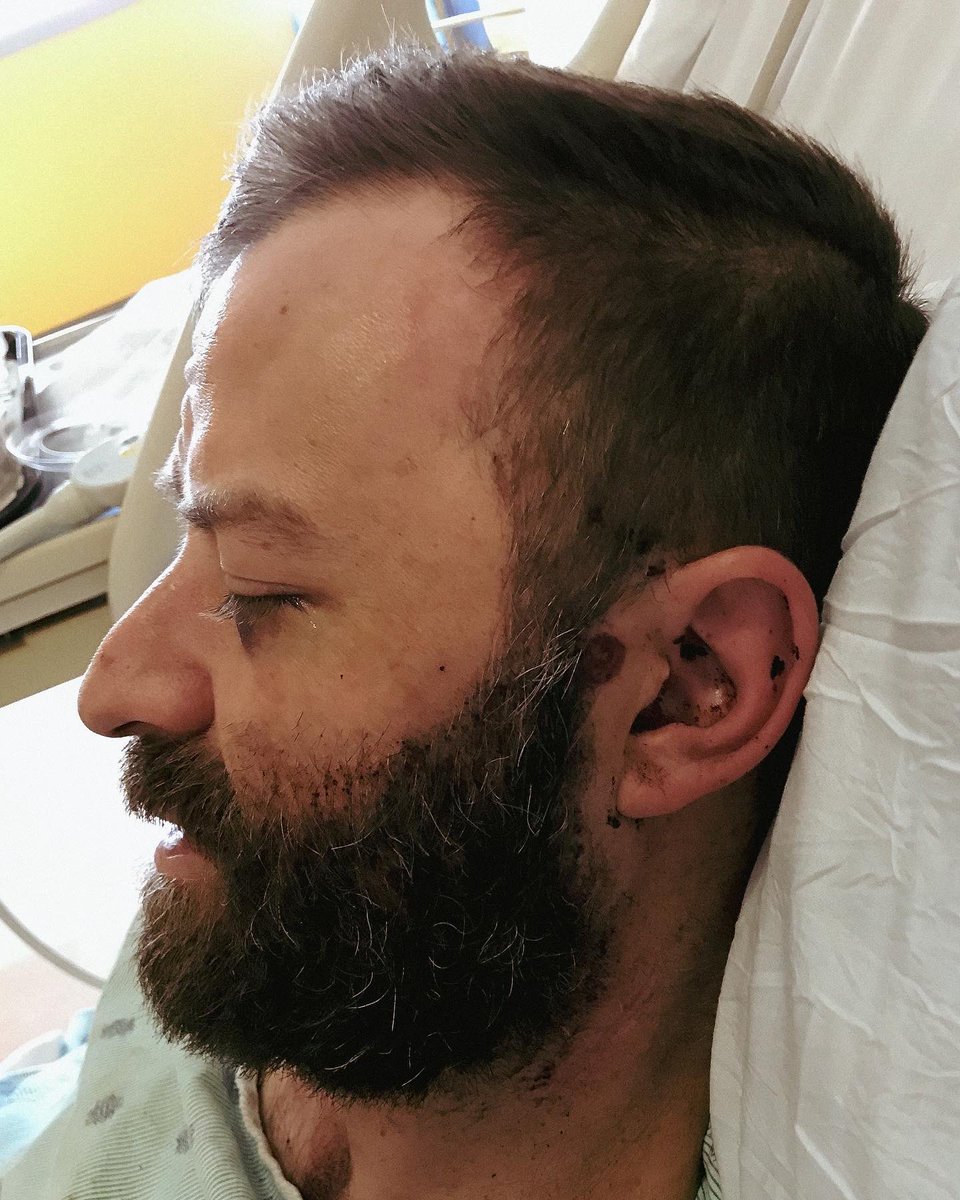 cvock's tweet photo. A year ago I was shot through the head &amp; face in Baltimore. Since then I’ve done everything I could to recover my mind/body/soul as much as possible—a long, wild journey. Experiencing what a single bullet can do, I think it’s important that people actually see it. #EndGunViolence https://t.co/wiP7PWrEyR