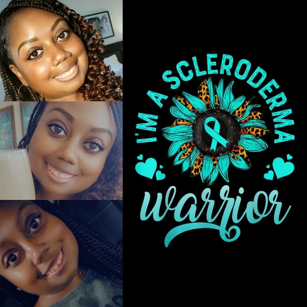 _key2yourheart's tweet image. June is Scleroderma Awareness Month! I'm in the fight of my life, but I WILL WIN! Check out @scleroderma and/or @srfcure for more information.
.
.
#Scleroderma #SclerodermaWarrior #KnowScleroderma #SclerodermaAwarenessMonth 💚🦋💙
