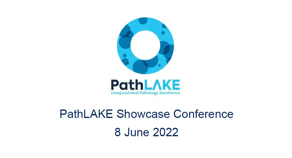 BPRGUoN's tweet photo. Just one more week until the @PathLAKE_CoE showcase conference. Looking forward to sharing with delegates what we've achieved in the #breastcancer project. https://t.co/YAvSZObeaH