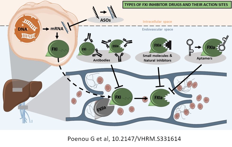 What should we expect from anti-XI in the prevention of venous thromboembolism?

👏 <a href="/zudenstein/">Geraldine POENOU</a>, <a href="/Med_Teo/">Teona Dumitru Dumitru</a>, <a href="/LudoLafaie/">Lafaie Ludo'</a>, V Mismetti &amp; M Heestermans for their very clear review.

<a href="/Univ_St_Etienne/">Université Jean Monnet Saint-Étienne</a> <a href="/ChuSaintEtienne/">CHU de Saint-Étienne</a> <a href="/MedvascC/">MedVasc&Therapeutique_CHUSE</a>    

<a href="/DovePress/">Dove Medical Press</a> dovepress.com/factor-xi-inhi…