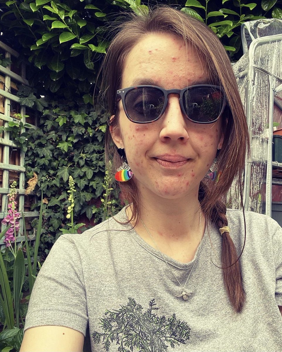 PigletJewellery's tweet photo. This is lovely Sophie; long term Piglet, lover of books, nature and rocker of acrylic jewellery...outdoors wearing the rainbow bee earrings. 🐝🌈💗
#littlepigjewellerydesign #beeearrings #rainbowbee #sewingbee #broochlover #broochlovers #acrylicjewellery #acrylicearrings #bee https://t.co/bZ13fkmHTZ