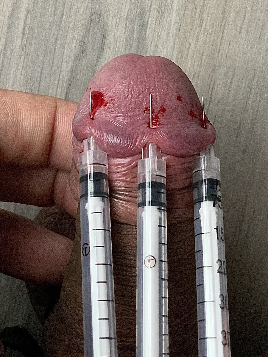XXneedle's tweet photo. ผมไหวแค่ 3 เข็มครับนาย @MasterShai_BDSM  #needle #needletorture #bdsm #fetish #master #slave #นายทาส #ทาส #นาย #เกย์ #เงี่ยน #bondage #pin #sex #gay #cumcontrol https://t.co/zvOS5XwP5x