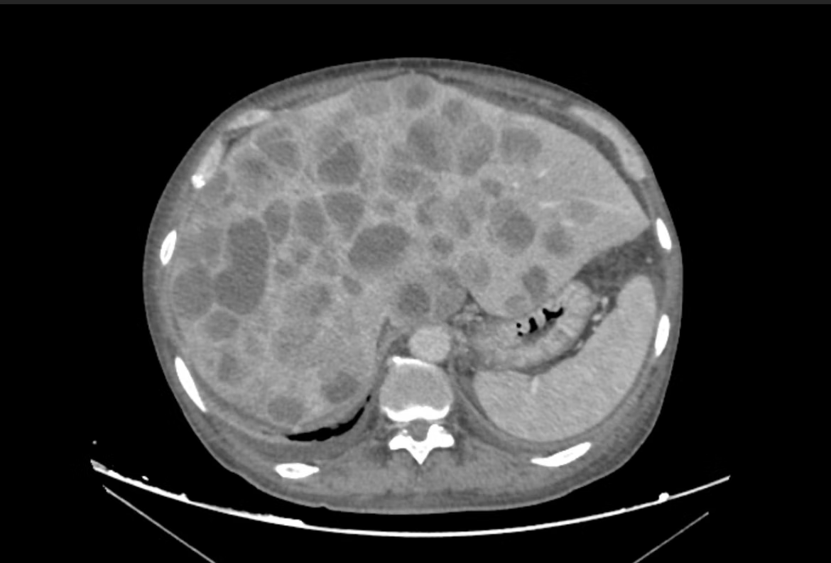 EndoCollab™ | GI Endoscopy Community tweet media