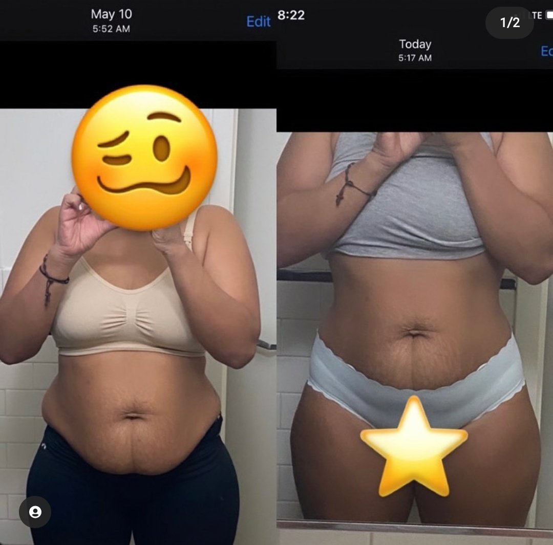 itsLydiaHoney's tweet photo. Have a look at the difference 🥺😍😍😍
📲 +27 (65) 977 2593
🛍 https://t.co/d40g3IxdUz
🌎 Available worldwide
#ا #ad #lydz_andhealth #FetchYourBody2022 #NationalShutdown #FuelPrice #PetrolDieselPrice #trinityspaces #anything #ramaphosamustgo #Konka60 https://t.co/griOYqWh7o