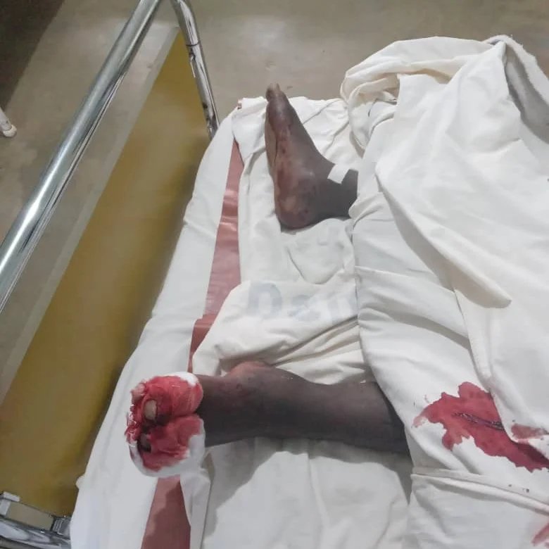 Twaha_Mwaipaya's tweet photo. POLISI WAPIGA MTU MPAKA KUFA KARATU.

Ni hivi Mwishoni mwa wiki Jana Police Karatu walimkamata Kijana Mmoja kwa tuhuma za wizi na walipo Mkamata wakampiga sana kwa kumtaka aseme na wenzake ambao walikuwa wakishirikiana kuiba sasa huyo kijana Baada ya Kupigwa sana ikabidi aanze 👇 https://t.co/RRMR6InANj
