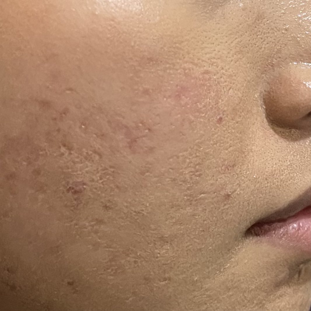 cloudysnowys's tweet photo. beberapa hari yang lalu aku ngelakuin teknik make up yang salah, tapi akhirnya aku tau apa yang harus aku lakuin &amp; apa yang ga harus aku lakuin.

aku mau sharing aja tips &amp; trick biar make up ga peeling, tentunya jadi nempel dengan baik👍🏻

#racuninmakeup #racuninskincare https://t.co/kv5rFuWrQ1