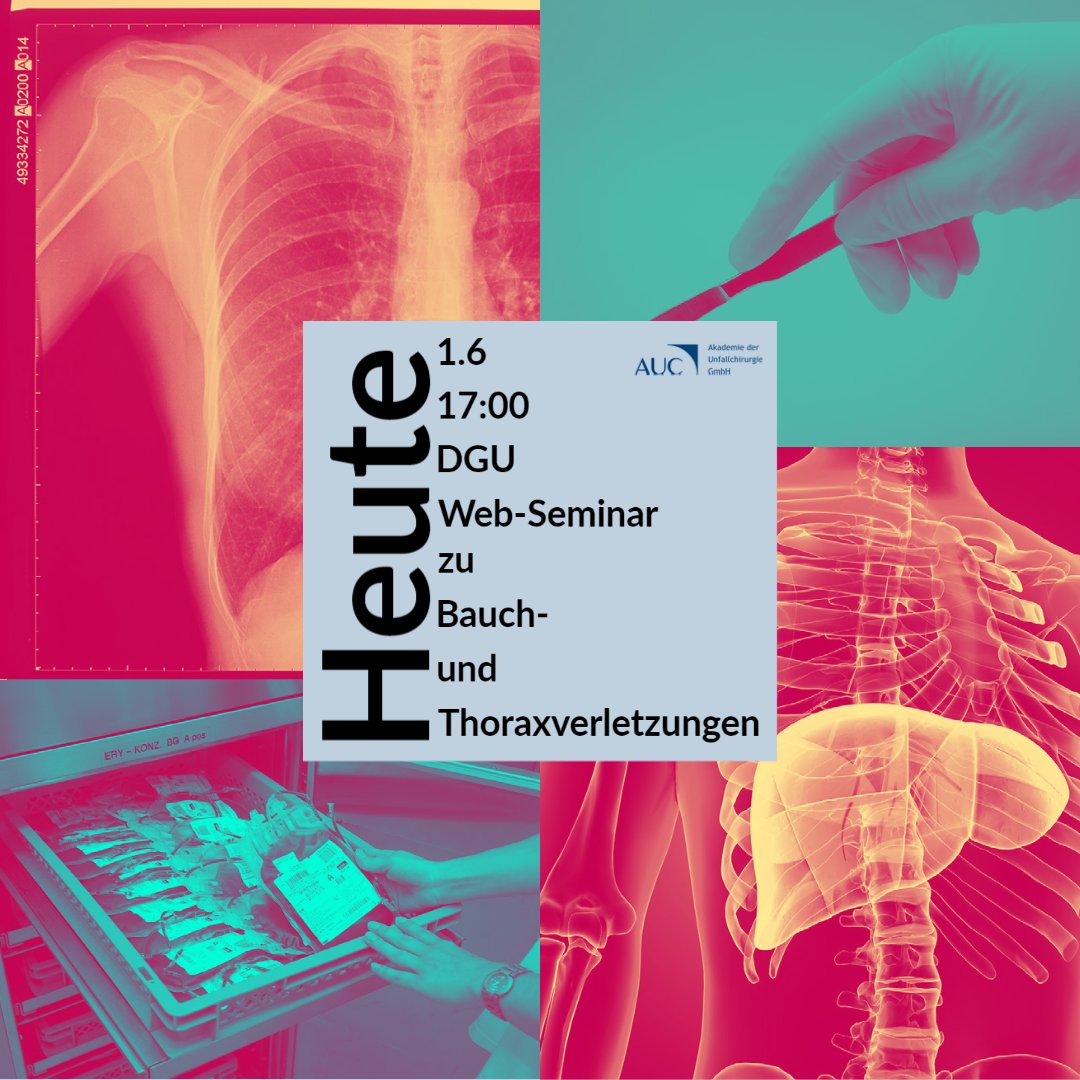Heute um 17:00 Uhr stellen wir zwei spannende Fälle zu Bauch- und Thoraxverletzungen vor. Schalten Sie ein und begleiten Sie uns und unsere Gäste bei der kontroversen Diskussion. Wie immer live und kostenfrei... #Unfallchirurgie #Viszeralchirurgie  bit.ly/3x6sq29