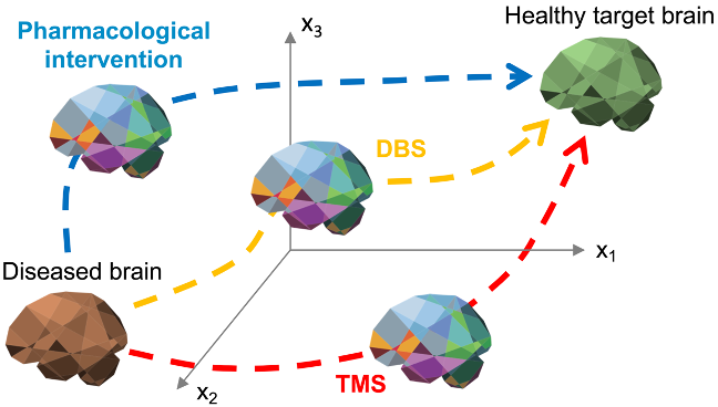 Finally our model for virtual deep brain stimulation was published 😃 
Can we use modeling to understand and optimize DBS?
We designed a multiscale brain network model to study the effects of DBS on a Parkinson’s disease patient network and found…🧵👇
sciencedirect.com/science/articl…
