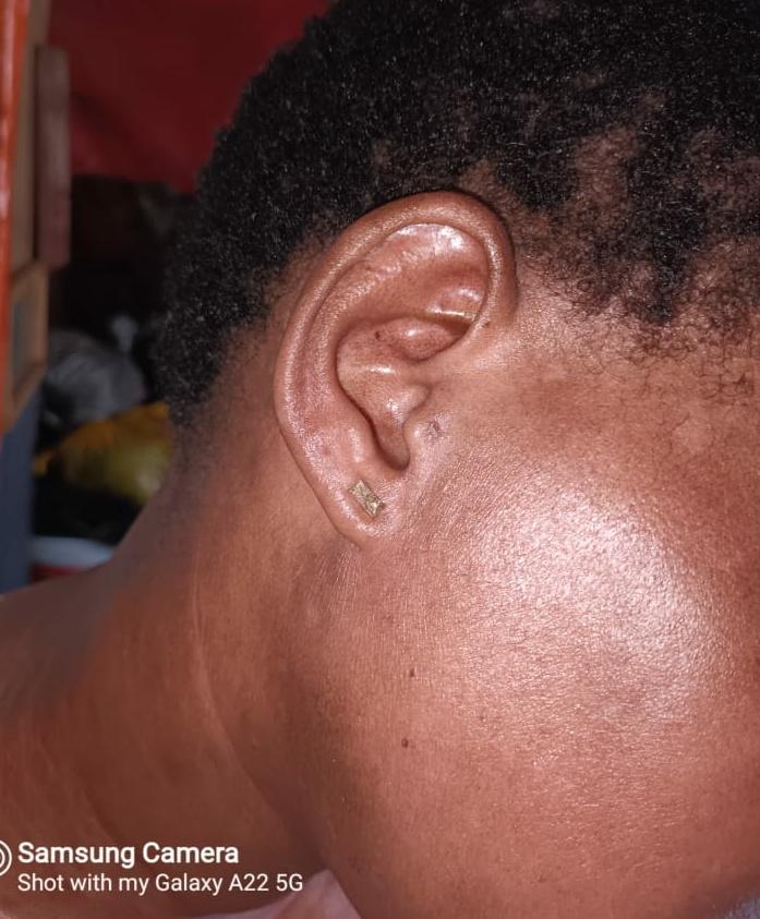 Qokani's tweet photo. Guys we are now glowing and the hair is growing nicely. she is thanking everyone who made it possible for her to reach uMhlongo and I'm thanking to all those who believe in my Godly herbs. 😝💚 https://t.co/Tobfryhib5