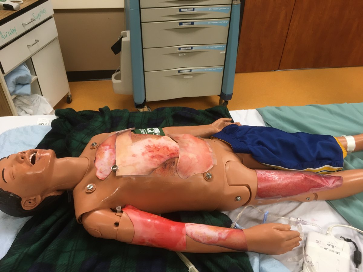 CSBL (@csblmcmaster) on Twitter photo What a quick way to make Burn moulage! Looks amazingly realistic! Thank you, <a href="/lisabonney01/">Lisa Bonney</a> !😀 What a quick way to make Burn moulage! Looks amazingly realistic! Thank you, <a href="/lisabonney01/">Lisa Bonney</a> !😀