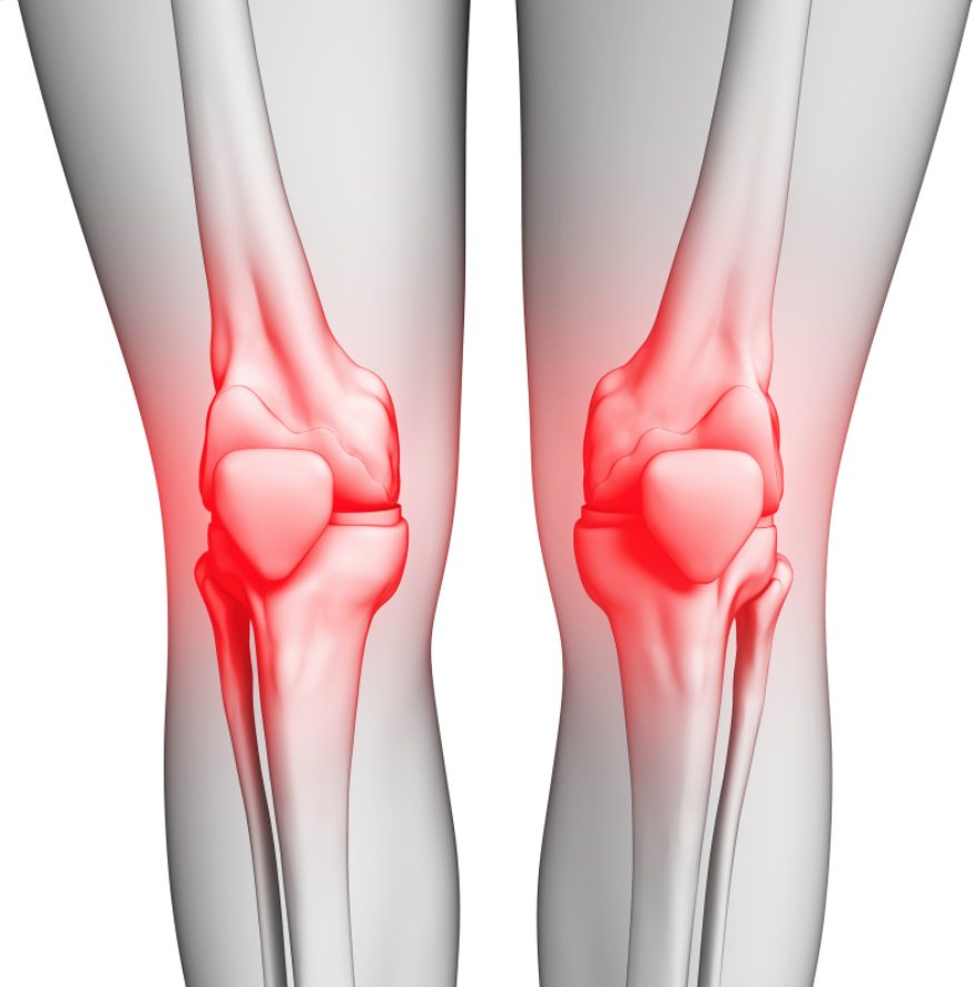 leslievidalmd's tweet photo. Knee pain can have a significant impact on your daily life. If you are experiencing any of the following symptoms for more than a few days or if your #kneepain worsens, contact Dr. Vidal at https://t.co/W1yzUslbE0

· Pain behind the knee
· Pain in the kneecap
· Severe #jointp ... https://t.co/yswKqctwZ3