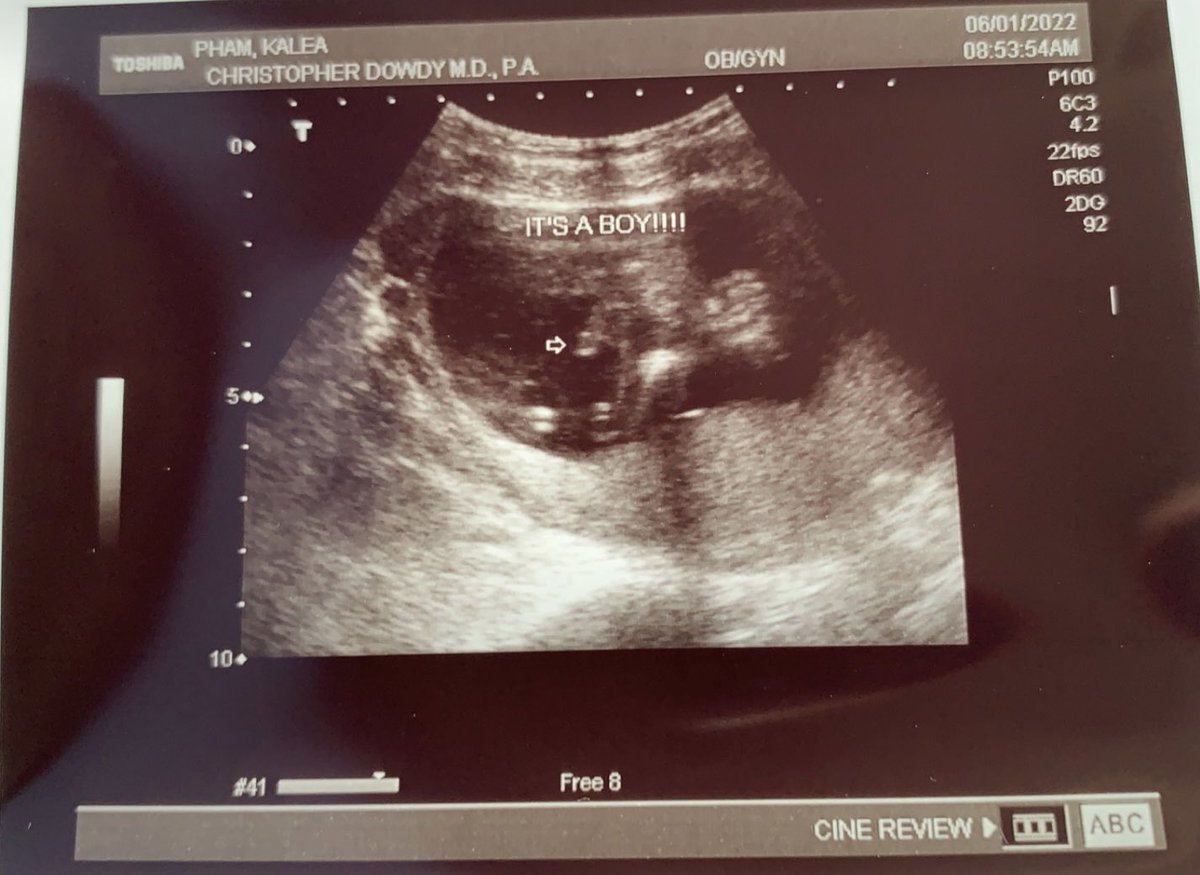 phamkalea's tweet photo. Still can’t believe I get to be YOUR mama. I love you so much little man 🥺💙 https://t.co/ZIp7BioiXg