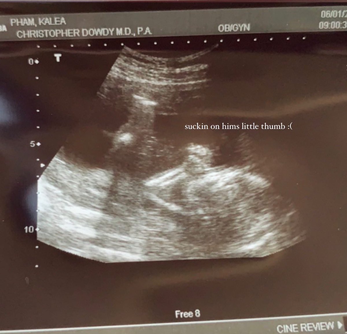 phamkalea's tweet photo. Still can’t believe I get to be YOUR mama. I love you so much little man 🥺💙 https://t.co/ZIp7BioiXg