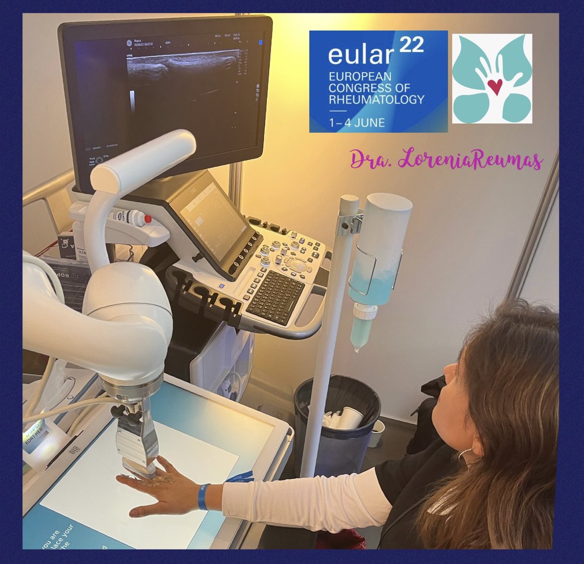 LoreniadB's tweet photo. Futuro robótico para ultrasonido Articular, ya no más Reumas Ecografistas? 😰😰😱😱😅😅🤪🤪😅, y la receta también?, jiji bueno supongo que ayudará…#EULAR22 #eular_org #drmariochavez #ArtritisReumatoide #ReumaJoven #deshire_alpizar #MtzReuma #drmariochavez #SMUGcourses https://t.co/Uzu38tON9y