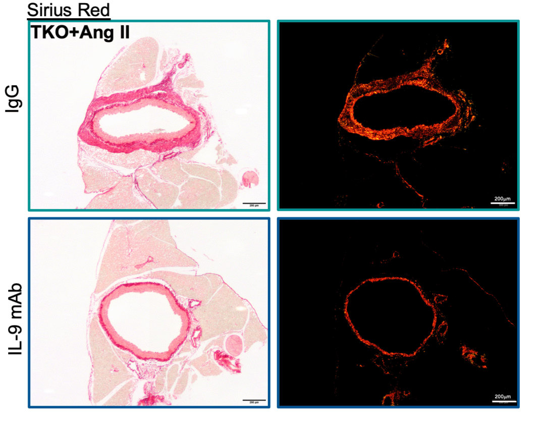 CircRes's tweet photo. Zhuang &amp; colleagues discovered that #Tcell specific removal of #Klf10 exacerbated perivascular #fibrosis &amp; multi-organ dysfunction in an #AngII #hypertension mouse model through #IL9. Learn more at https://t.co/6A4XM05r9I  @bwhcvls @BrighamResearch @preetiaahir https://t.co/gfi5jVsjGd