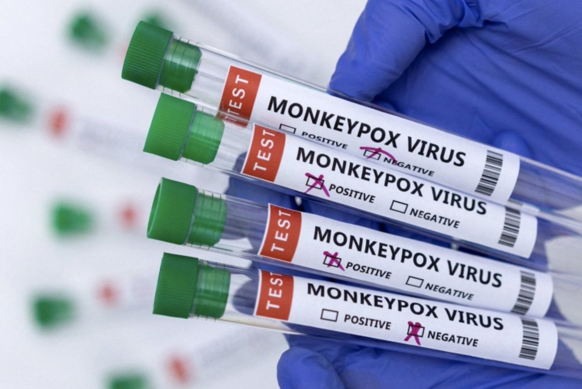 AJEnglish's tweet photo. WHO says that hundreds of monkeypox cases have surfaced beyond the African countries where the disease is typically found, warning that the virus has likely been spreading under the radar https://t.co/NDX1264pvf https://t.co/6sPBEsq3PK