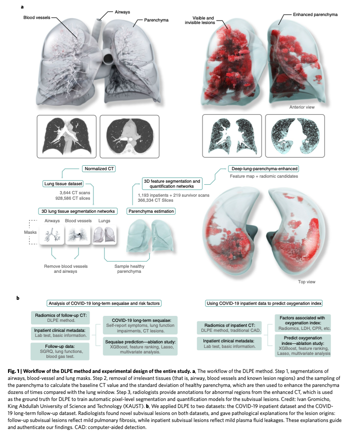BioDecoded's tweet photo. An interpretable deep learning workflow for discovering subvisual abnormalities in CT scans of COVID-19 inpatients and survivors | Nature Machine Intelligence
https://t.co/AoEixohndD

#DeepLearning https://t.co/sGALyQGo5u