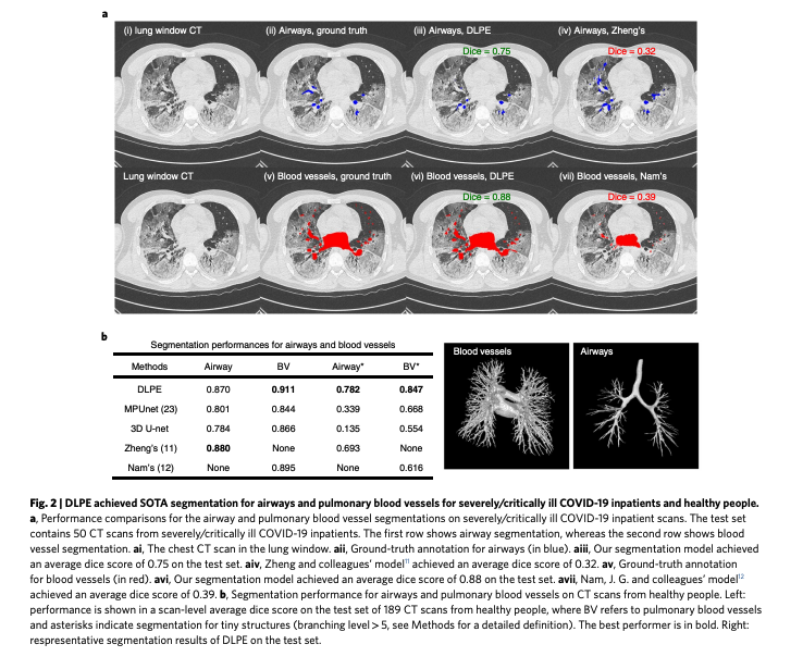 BioDecoded's tweet photo. An interpretable deep learning workflow for discovering subvisual abnormalities in CT scans of COVID-19 inpatients and survivors | Nature Machine Intelligence
https://t.co/AoEixohndD

#DeepLearning https://t.co/sGALyQGo5u