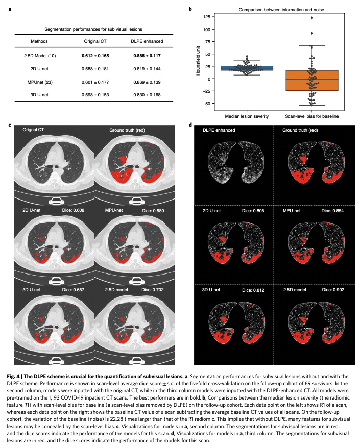 BioDecoded's tweet photo. An interpretable deep learning workflow for discovering subvisual abnormalities in CT scans of COVID-19 inpatients and survivors | Nature Machine Intelligence
https://t.co/AoEixohndD

#DeepLearning https://t.co/sGALyQGo5u