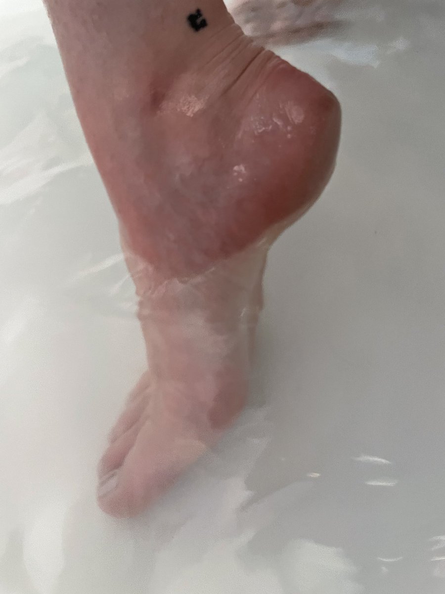 FreyaWild1's tweet photo. A little soak #feet #feetfethish #feetfinder #footgirl #onlyfansgirl https://t.co/Ow8CYY2ocj