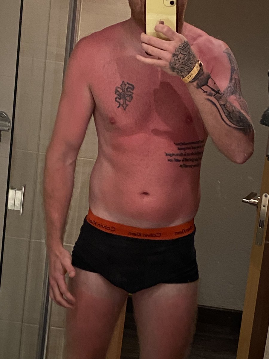 paulscaife1's tweet image. Think I missed the factor 50 today 😂 #gingerproblems