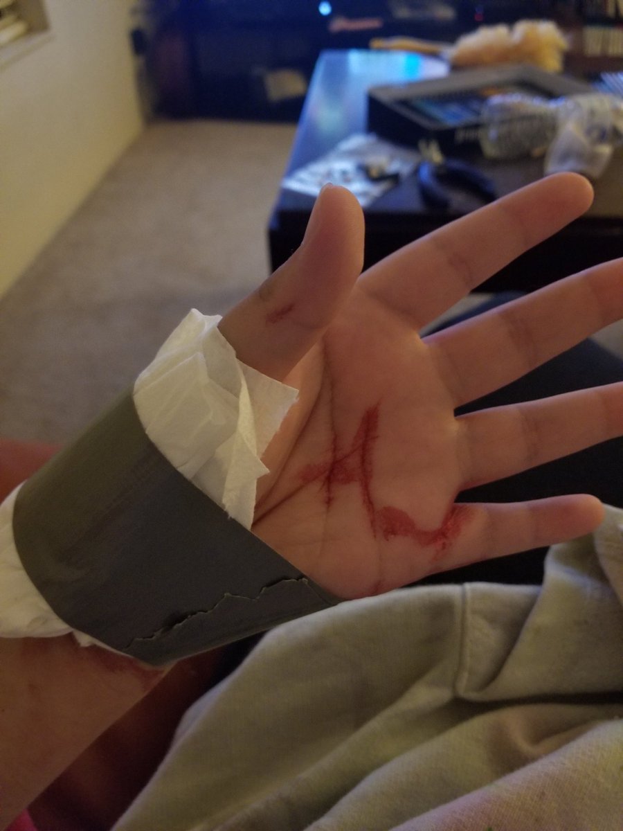 LolzEvan's tweet photo. !!!!!!!!!SFX MAKEUP!!!!!!!!!! 

Well something happened... 
#shtwt https://t.co/XMY5WkuMV5