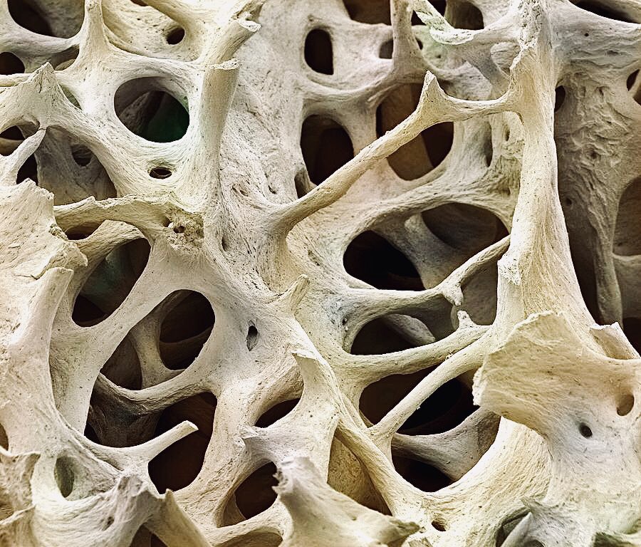 Spongy Bone Under Microscope