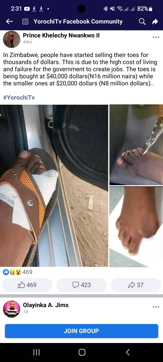erasmusvirtue's tweet photo. I've not verified this though. I'm hearing that people now sell their toes in Zimbabwe due to abject poverty. It looks like they've finished selling their kidneys.

Maybe they'll shift to their eyes later. 

#NationalShutdown Gerald Darmanin #Zimbabwe #GhanaBlackStars https://t.co/iXPwqTQO2I