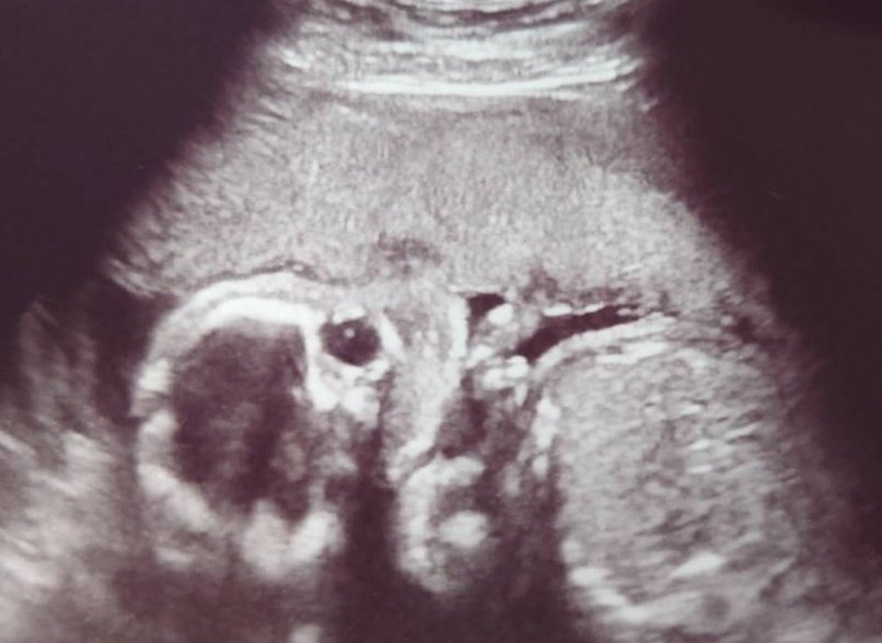 ちもちゃんまま Chimochan Mama Twitter ちもちゃんまま Chimochan Mama Twitter