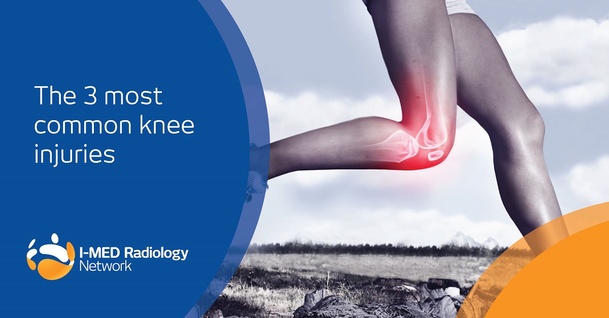 IMED_Network's tweet photo. #MRI produces detailed images of the soft tissues of the knee (including ligaments, menisci and articular cartilage), and is useful to confirm diagnosis of the three most common causes of #kneepain/injury. Find out more https://t.co/Olszh34rF9 https://t.co/pnTtf2XEoq