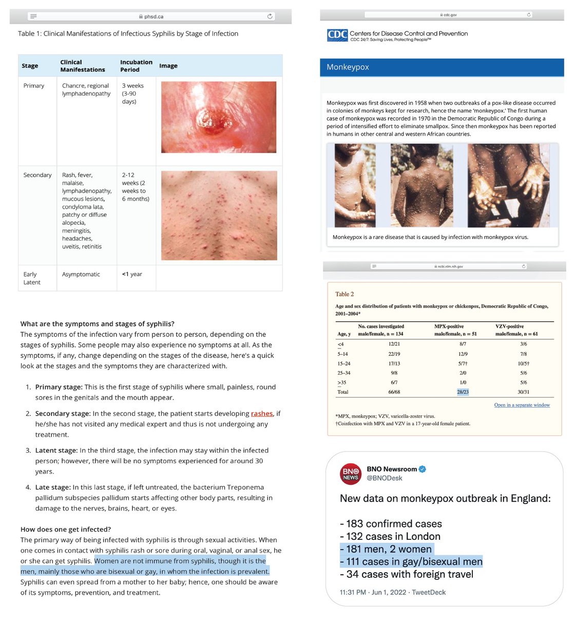 (1) Monkeypox กับ Syphilis สามารถมีอาการคล้ายกัน

(2) แต่ลักษณะการแพร่ต่างกัน:
MPX: ชายและหญิงติดใกล้เคียงกัน
SY: ติดเชื้อในชายเป็นหลัก ส่วนใหญ่เป็น เกย์ หรือ bisexual

ไฉน MPX ในปัจจุบันจึงแพร่เหมือน SY
โดยผู้ติดเชื้อในอังกฤษ 1% เป็นหญิง 99% เป็นชาย ส่วนใหญ่ เกย์ หรือ bisexual ?