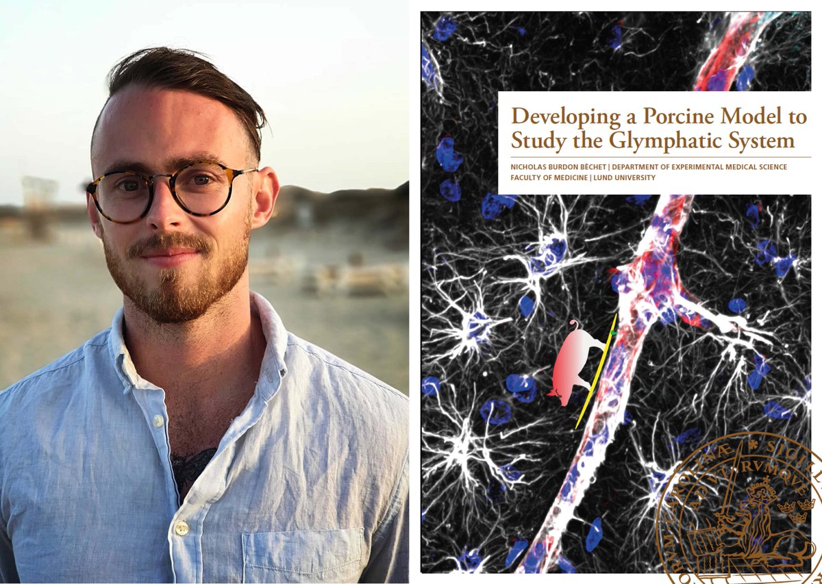 Friday 17 June, @NicBechet defends his Ph.D thesis about the #glymphaticsystem in #AD.  Here, he tells about his research in @Iben_Lundgaard group at MultiPark. @Medfak_LU #careerdevelopment #PhD #youngresearcher #neuroscience #glymphaticsystem multipark.lu.se/article/glymph…