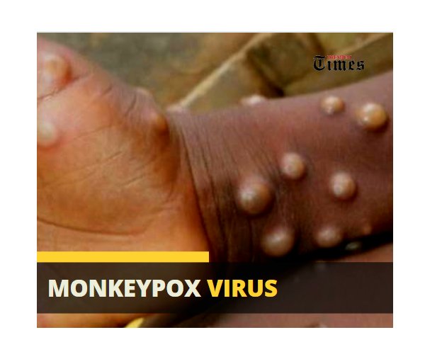 TwstdWrld's tweet photo. EPISODE 30 OUT NOW 🔥🔥🔥
"The Way The News Goes" 

Where to Listen: https://t.co/2Jic9tONGs

Apple Podcast: https://t.co/iKgdn91EPV

Spotify: https://t.co/DnwzcCIDZs

#TWSTDWRLDPodcast #monkeypox #Johnny #AmberHeard #formulacrisis #TWSTDWRLD #News #CodyIsMissing #Depp #Texas https://t.co/cS8F2na8Mf