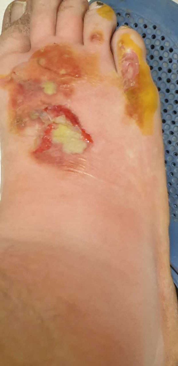 PelleSunvisson's tweet photo. Svenska jordgubbar till midsommar?

Vill berätta om M. Genom en facebookgrupp för ukrainare fick han kontakt med en lantbrukare i södra Sverige. Han lovades vitt arbete, 90 kr netto i timmen och schysta villkor. Första dagen arbetade han 6.00-23.45, andra dagen 6.00-20.45. -> https://t.co/0KyySc5E1V
