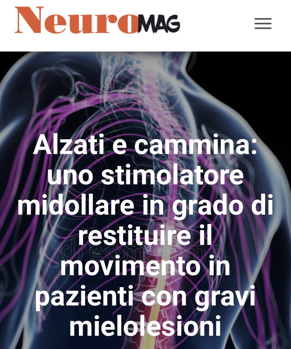 È online su NEUROMag un nuovo articolo di Francesco Iodice dal titolo "Alzati e cammina: uno stimolatore midollare in grado di restituire il movimento in pazienti con gravi mielolesioni".

Clicca qui!⬇️
neuromag.it/?p=1672&previe…

#giovanineurologi #sign #neurology