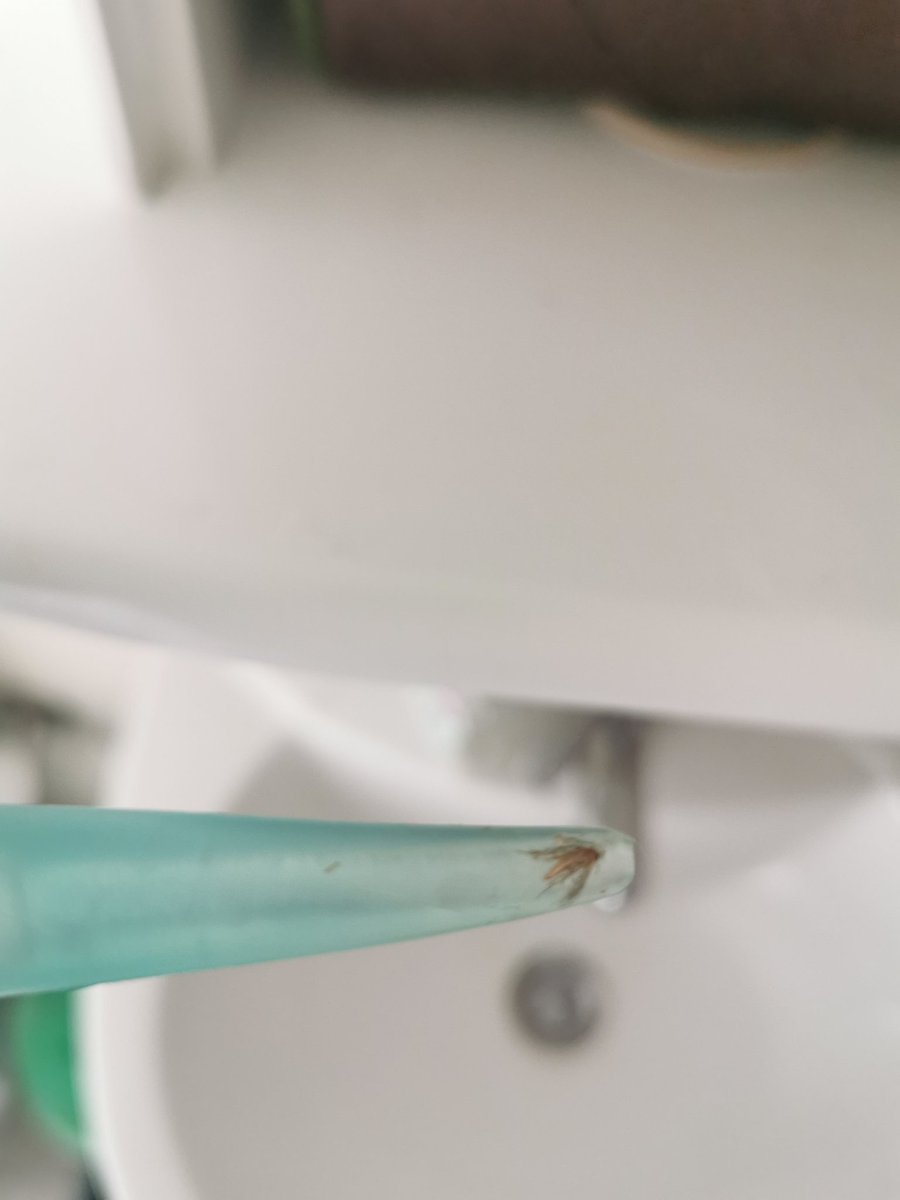 A FUCKING MOTH JUST CRAWLED INTO MY EAR CANAL IT WAS THE WORST THING EVER