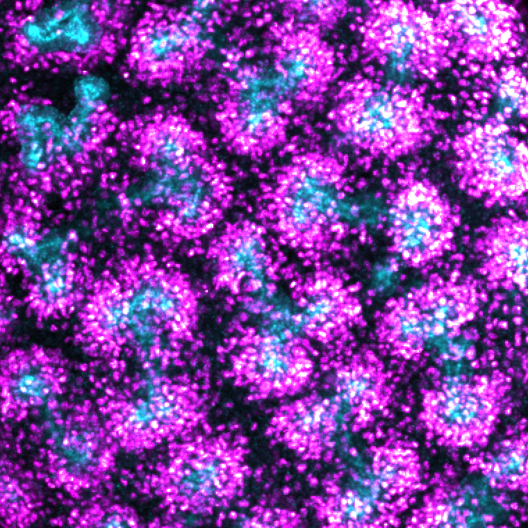 lsprahl's tweet photo. Happy cap mesenchyme day, to those who celebrate! #Six2 #kidney https://t.co/1hTdVxOPQy
