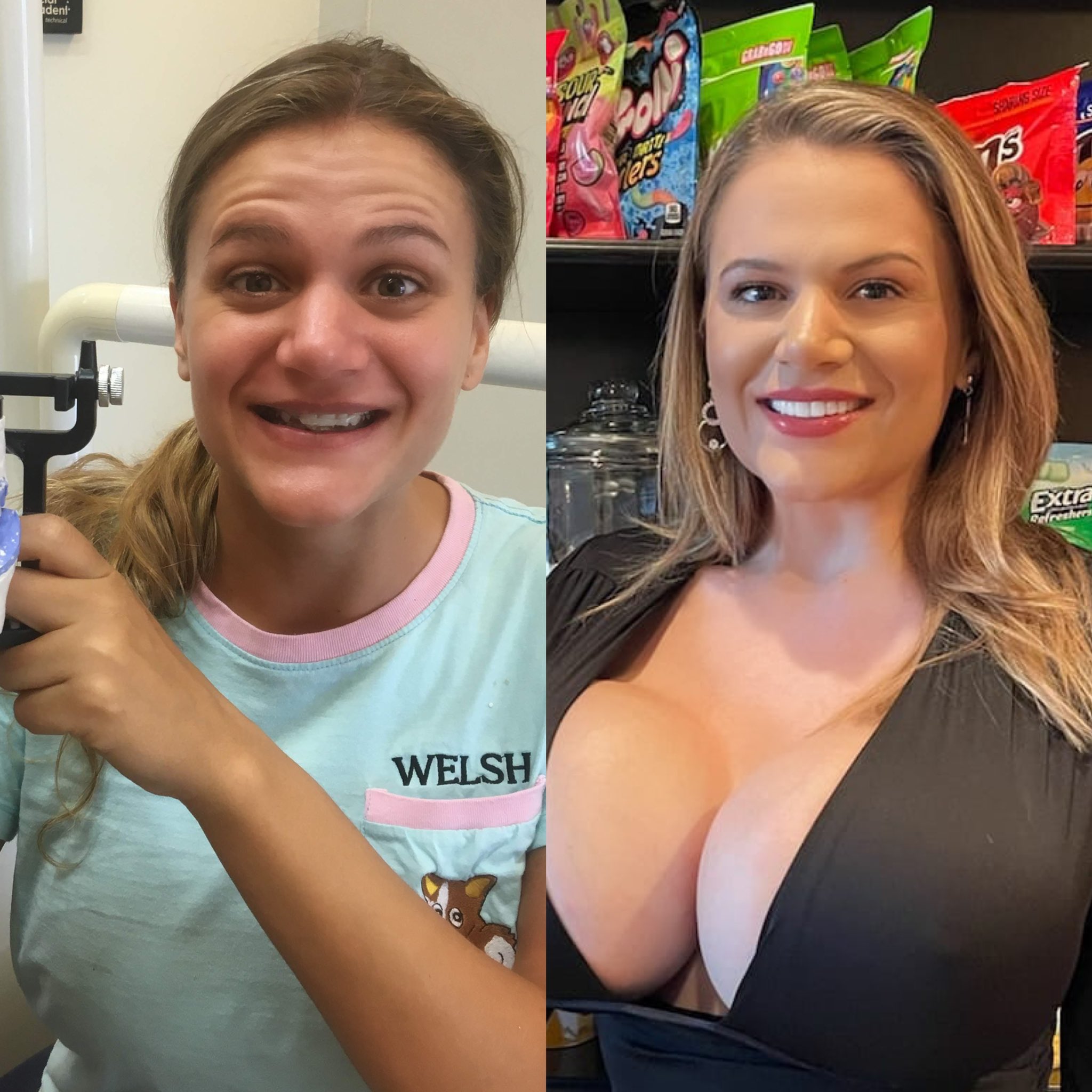 Solyluna24 Onlyfans: Before And After The Leak - 62z1w0x