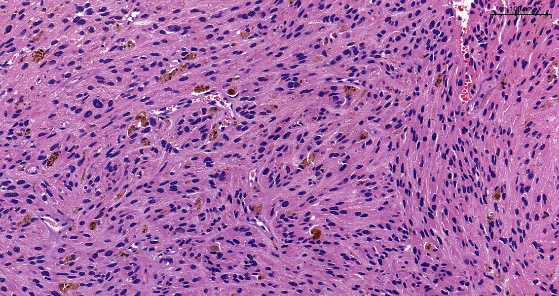 SEAP_IAP's tweet image. Enhorabuena a Cristian Benavides de la Fuente, residente de 3er año del Hospital Universitario Puerta del Mar (Cádiz) por ser el autor de nuestro #CasoDelMes de junio. 

seap.es/web/guest/actu…