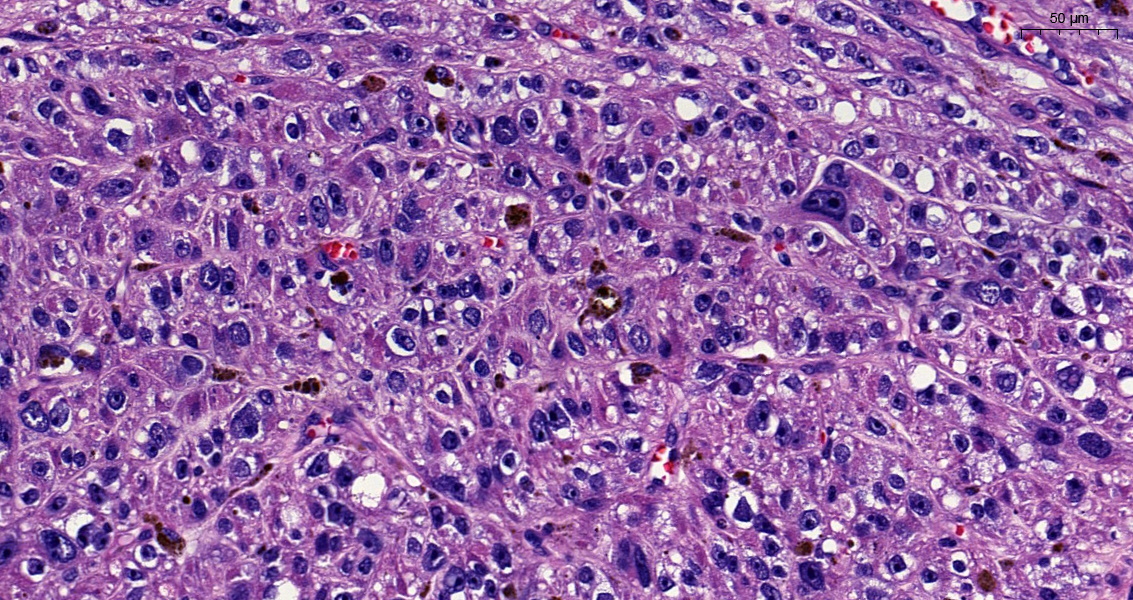 SEAP_IAP's tweet image. Enhorabuena a Cristian Benavides de la Fuente, residente de 3er año del Hospital Universitario Puerta del Mar (Cádiz) por ser el autor de nuestro #CasoDelMes de junio. 

seap.es/web/guest/actu…